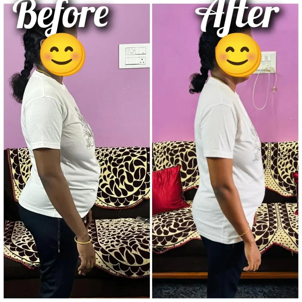 Before-After-Transformation-20.webp